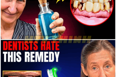 DENTISTS HATE THIS OIL: REVERSES Tooth Decay & Heals Teeth | Barbara O’Neill – HTT