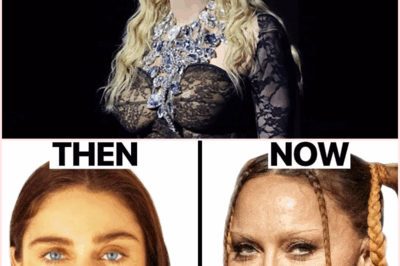 Madonna’s Transformation: The Shocking Truth Behind Her Plastic Surgeries Revealed!